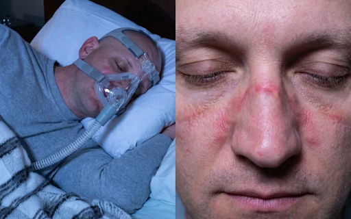 CPAP machine and sleep apnea treatment